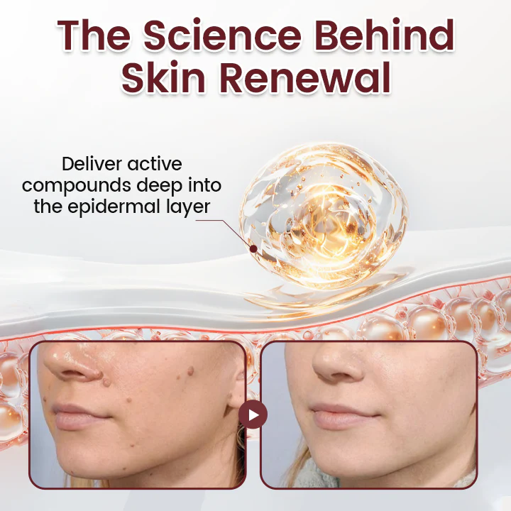 Fivfivgo® BumpAway Gentle Renewal Cream