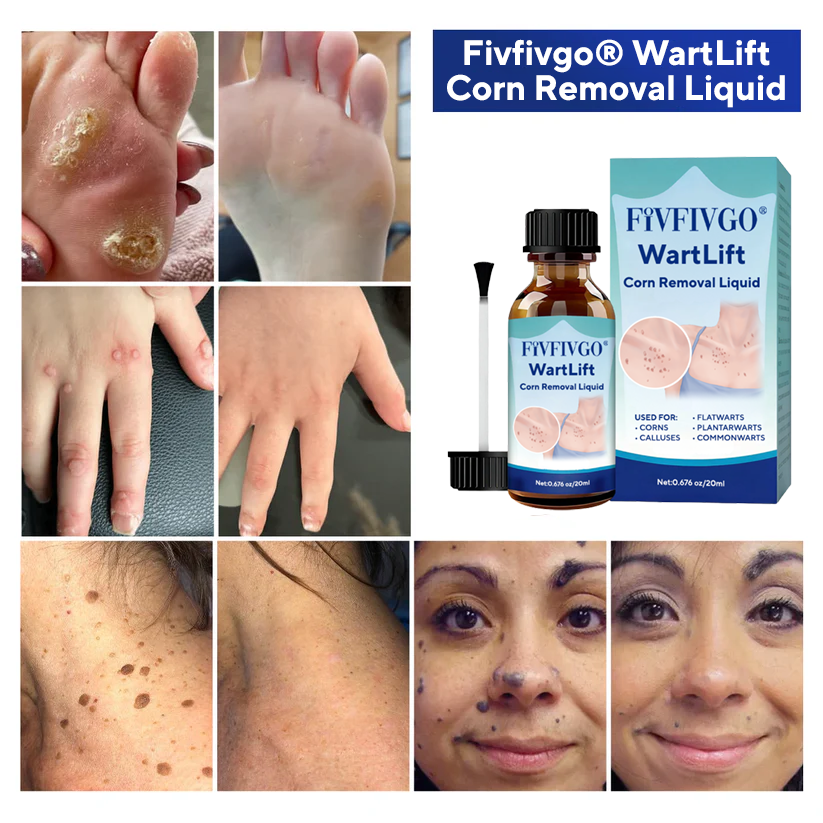 Fivfivgo® WartLift Corn Removal Liquid
