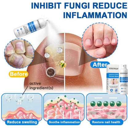 Fivfivgo® Magnesium Herbal Psoriasis Spray