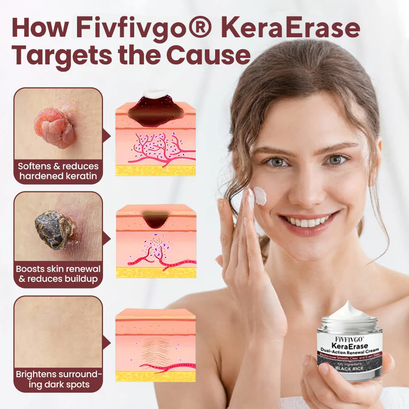 Fivfivgo® KeraErase Dual-Action Renewal Cream image Fivfivgo® KeraErase Dual-Action Renewal Cream