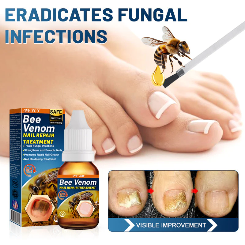 Fivfivgo™ Bee Venom Nail Repair Treatment (The Ultimate Solution for Toenail Fungus)