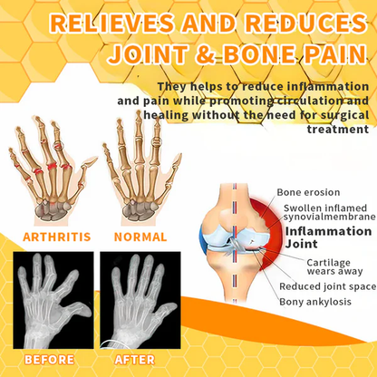 Fivfivgo™ Bee Venom Joint Therapy Pain Relief Gel