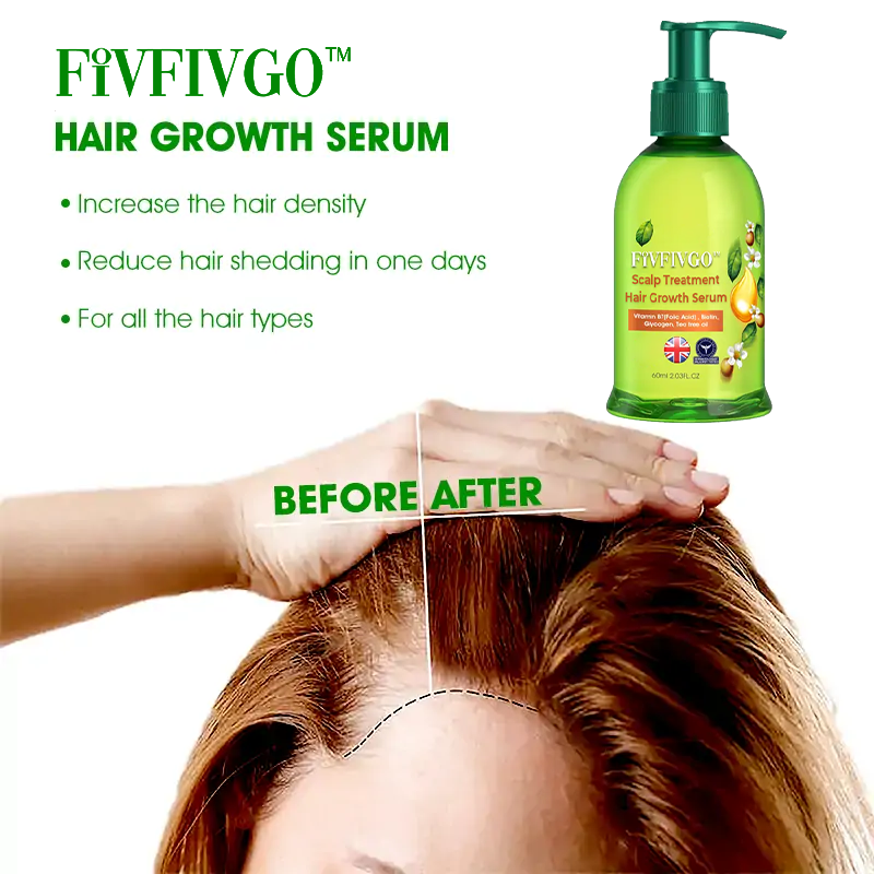 Fivfivgo™ Scalp Treatment Hair Growth Serum