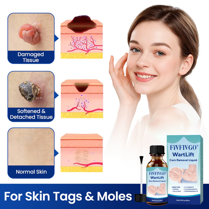 Fivfivgo® WartLift Corn Removal Liquid