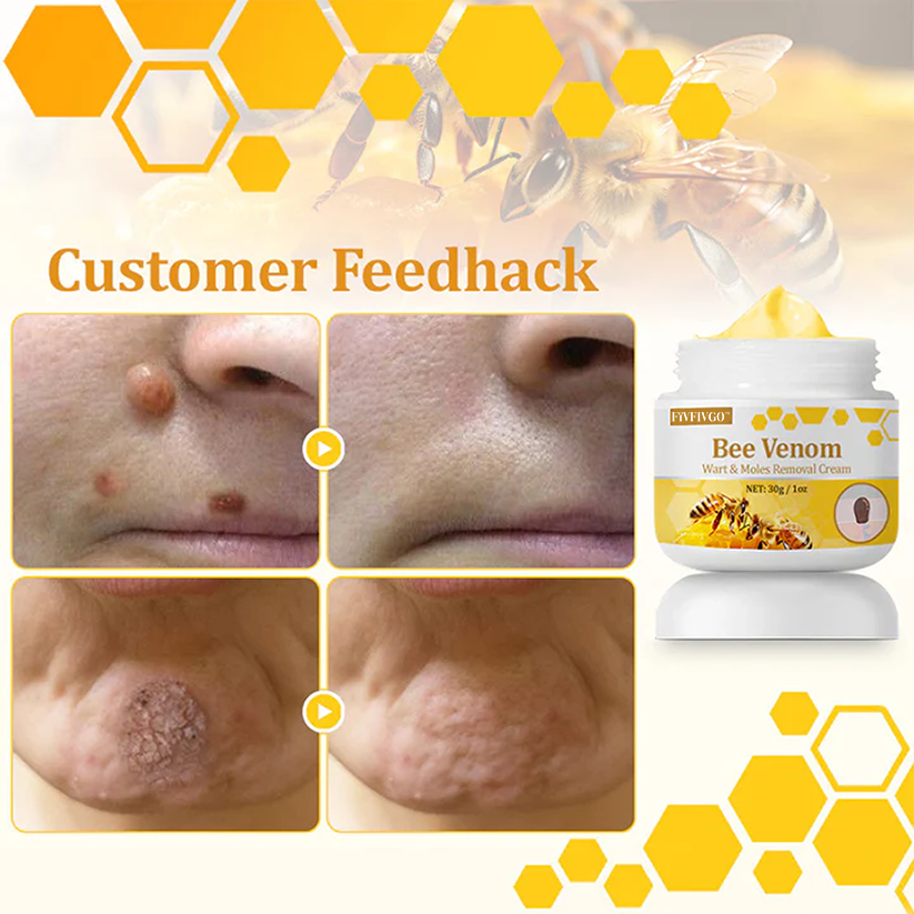 Fivfivgo™ TagCure Bee Venom Wart & Moles Removal Cream🐝