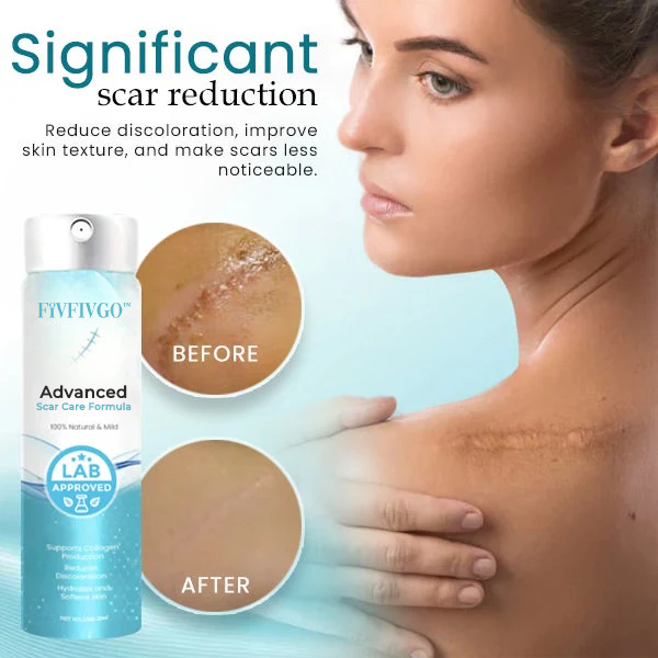 Fivfivgo™ Advanced Scar Care Formula