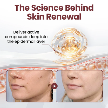 Fivfivgo® KeraErase Dual-Action Renewal Cream