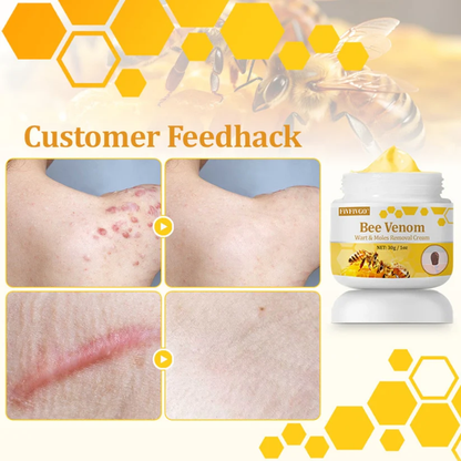 Fivfivgo™ TagCure Bee Venom Wart & Moles Removal Cream🐝