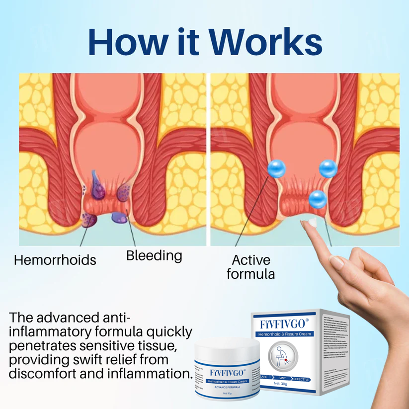 Fivfivgo® Hemorrhoid & Fissure Cream image Fivfivgo® Hemorrhoid & Fissure Cream