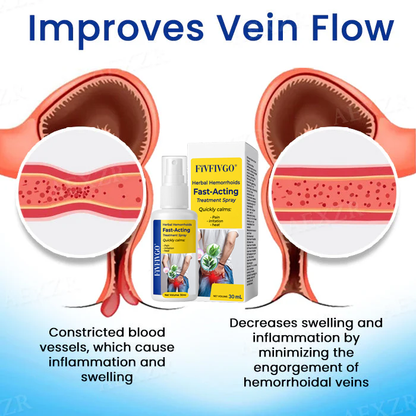 Fivfivgo® Herbal Hemorrhoids Fast-Acting Treatment Spray