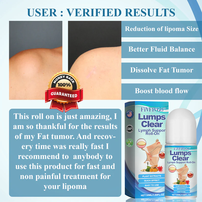 Fivfivgo™ LumpsClear Lymph Support Roll-On