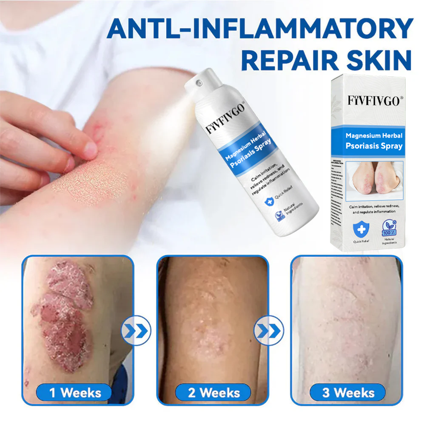 Fivfivgo® Magnesium Herbal Psoriasis Spray
