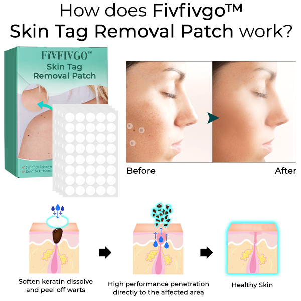 Fivfivgo™ Skin Tag Removal Patch