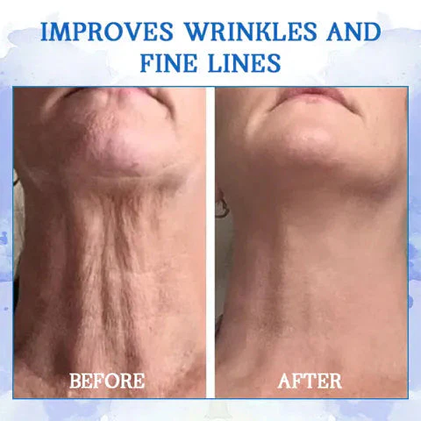 Fivfivgo™ Advanced SkinTightening Rejuvenating Cream