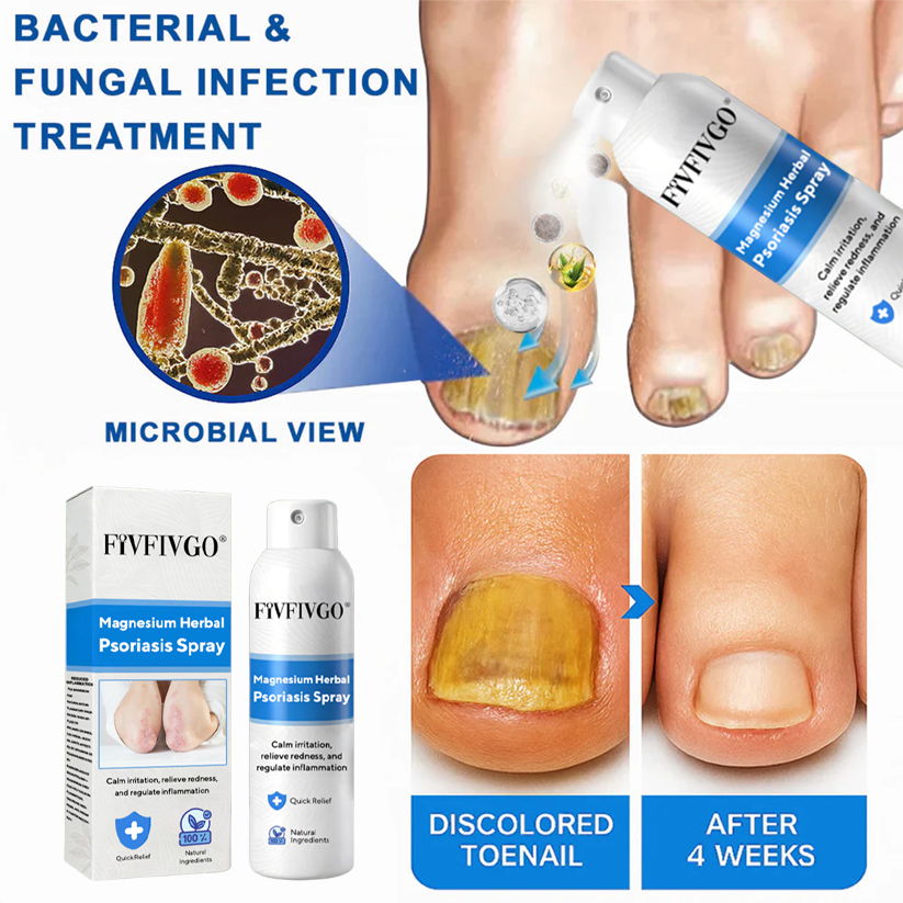Fivfivgo® Magnesium Herbal Psoriasis Spray