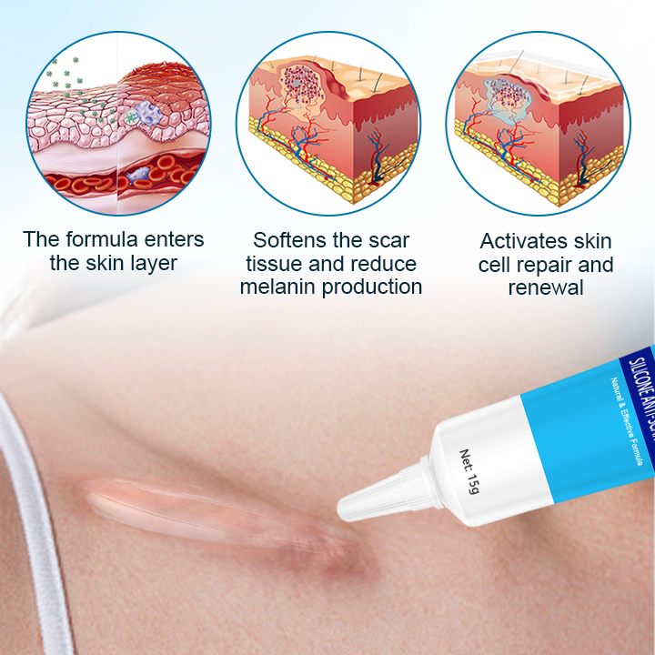 Fivfivgo™ Silicone Anti-Scar Cream