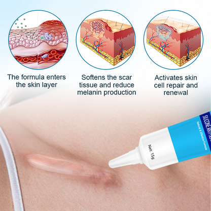 Fivfivgo™ Silicone Anti-Scar Cream