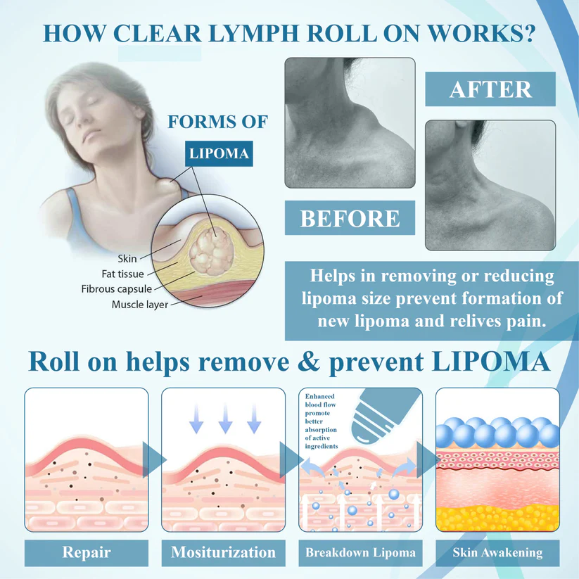 Fivfivgo™ LumpsClear Lymph Support Roll-On