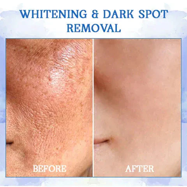 Fivfivgo™ Advanced SkinTightening Rejuvenating Cream