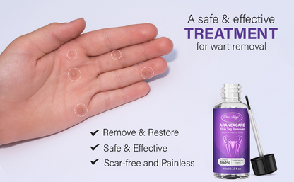 Oveallgo™ AraneaCare Skin Tag Remover