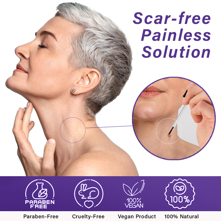 Oveallgo™ AraneaCare Skin Tag Remover