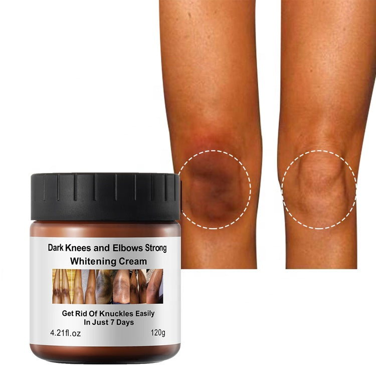 Fivfivgo™ Dark Knees and Elbows Lightening Cream