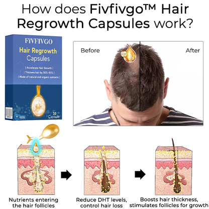 Fivfivgo™ Hair Regrowth Capsules