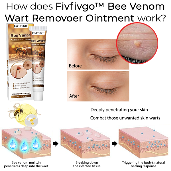 Fivfivgo™ Bee Venom Wart Removoer Ointment