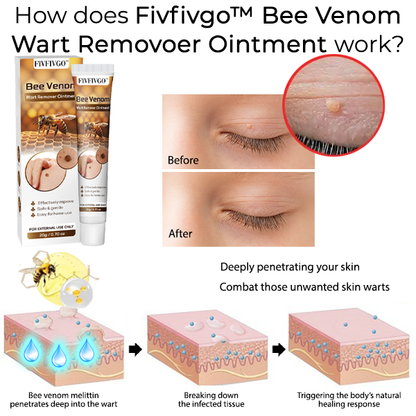 Fivfivgo™ Bee Venom Wart Removoer Ointment