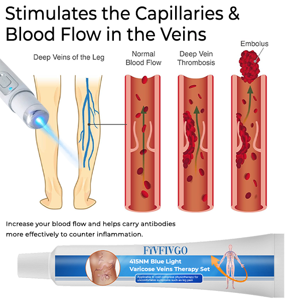 Fivfivgo™ 415NM Blue Light Varicose Veins Therapy Set