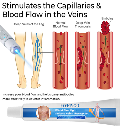 Fivfivgo™ 415NM Blue Light Varicose Veins Therapy Set