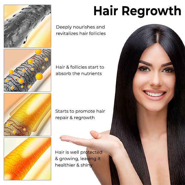 Fivfivgo™ Hair Regrowth Capsules