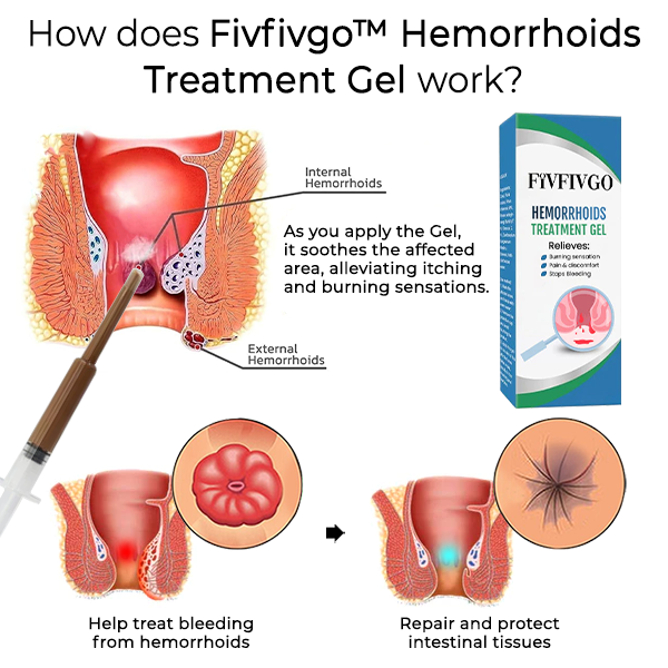 Fivfivgo™ Hemorrhoids Treatment Gel