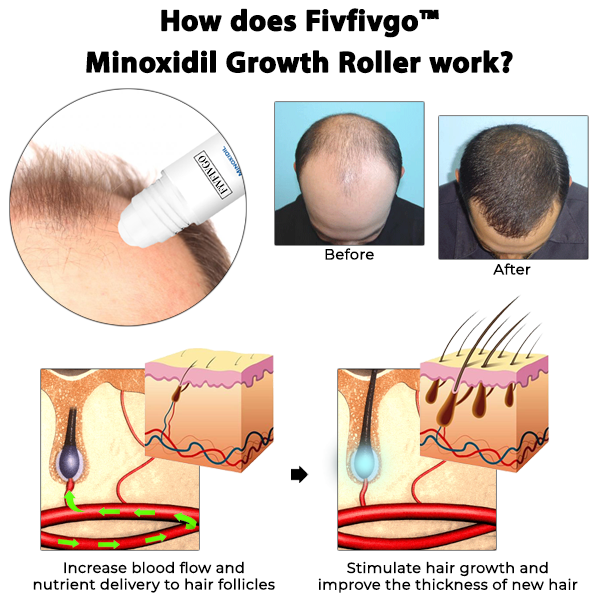 Fivfivgo™ Minoxidil Growth Roller