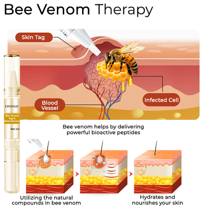 Fivfivgo® Bee Venom Tags & Moles Remover