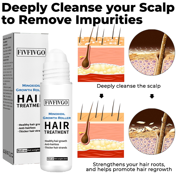 Fivfivgo™ Minoxidil Growth Roller