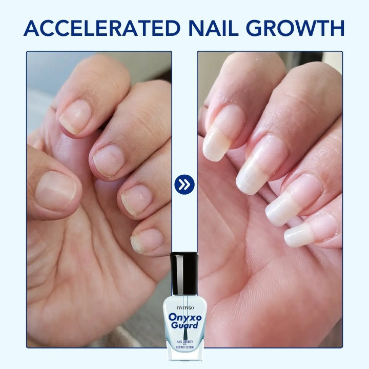 Fivfivgo™ OnyxoGuard Nail Growth and Repair Serum