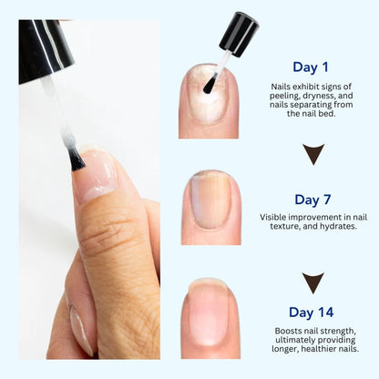 Fivfivgo™ OnyxoGuard Nail Growth and Repair Serum