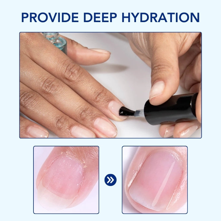 Fivfivgo™ OnyxoGuard Nail Growth and Repair Serum