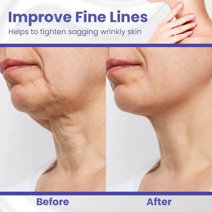 Fivfivgo™ SmoothLift Wrinkle Defense Cream