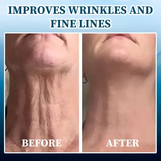 Fivfivgo™ Lifting and Anti-Wrinkle Serum (Rejuvenate and Firm Your Skin)