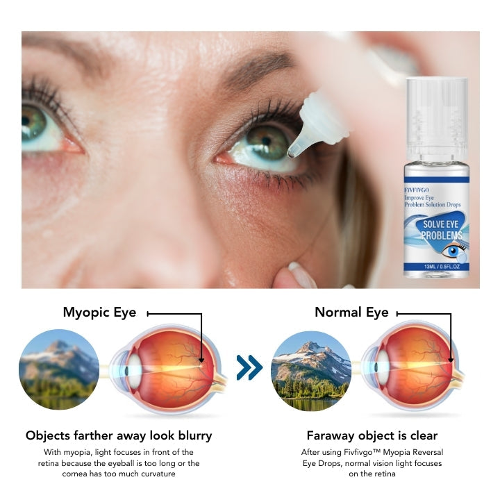 Fivfivgo™ Myopia Reversal Eye Drops