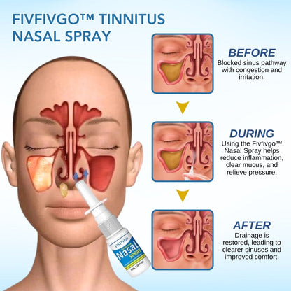 Fivfivgo™ Tinnitus Nasal Spray