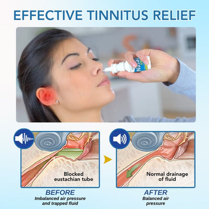 Fivfivgo™ Tinnitus Nasal Spray