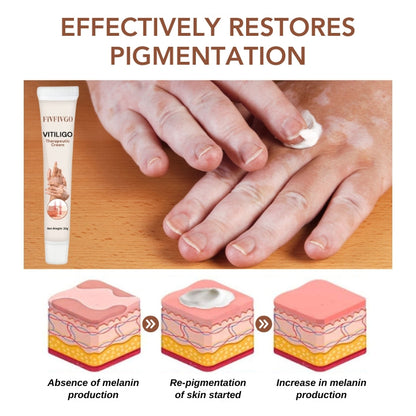 Fivfivgo™ Vitiligo Therapeutic Cream