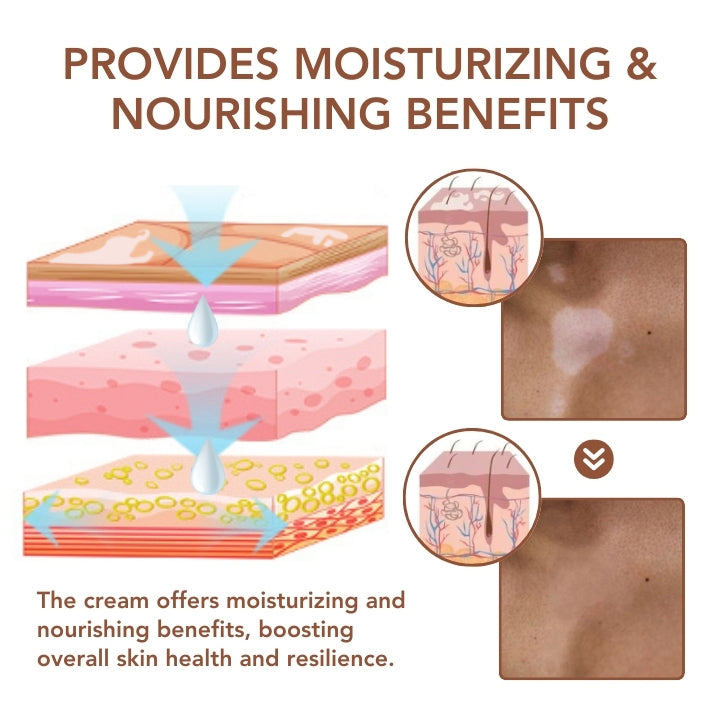 Fivfivgo™ Vitiligo Therapeutic Cream