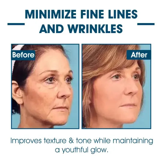 Fivfivgo™ Lifting and Anti-Wrinkle Serum (Rejuvenate and Firm Your Skin)