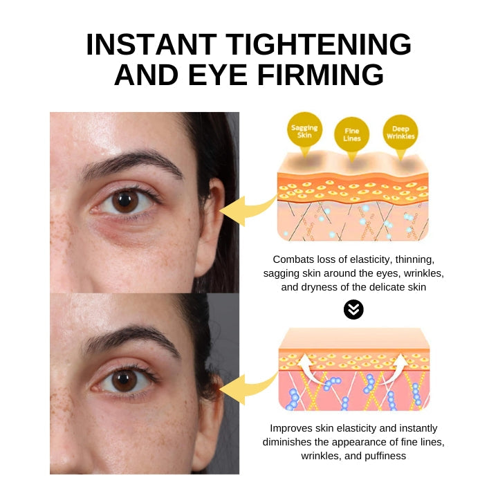 Fivfivgo™ Instant Eye Tightening Eye Gel