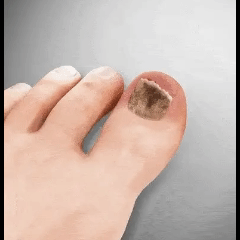 Fivfivgo® FungiBee Advanced Nail Repair Spray