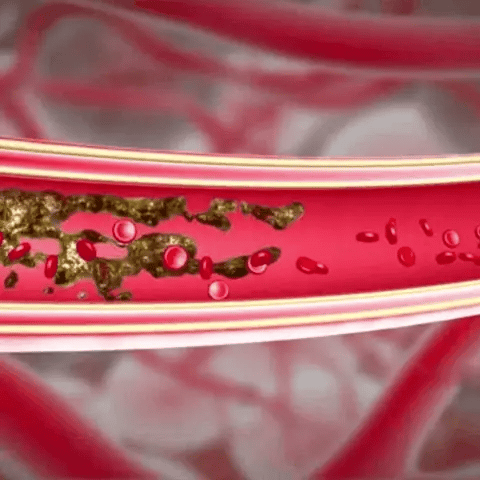 Fivfivgo® Magnesium Herbal Psoriasis Spray image Fivfivgo® Magnesium Herbal Psoriasis Spray